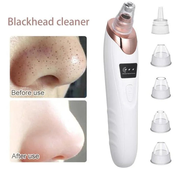 Multi-functional Electric Blackhead Remover & Pore Cleaner Deep Pore Cleansing Device
