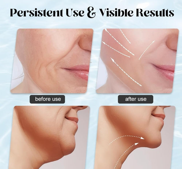 EMS Face Lifting Massager